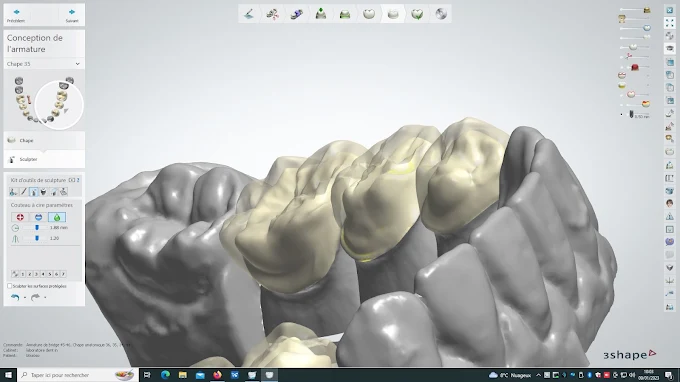 Laboratoire Dent'in